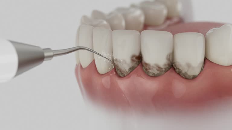 Reliable Teeth Cleaning And Checkup contractor in Missaukee County County, MI by Dentist Open Now